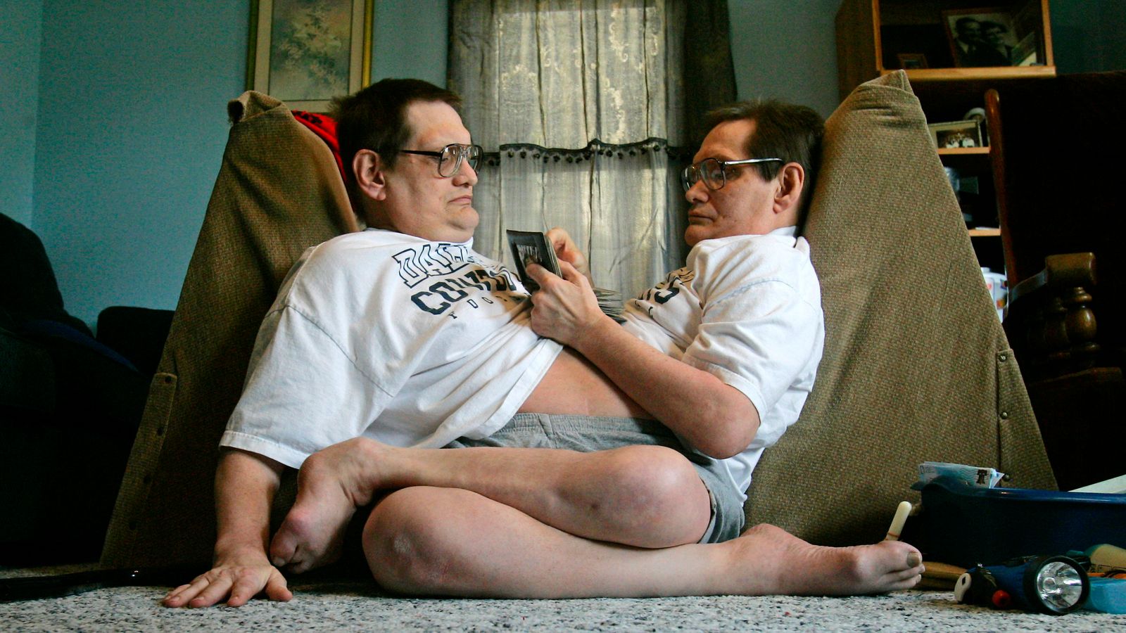The Weird Story of The World’s Oldest Conjoined Twins